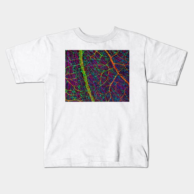 Retina blood vessels and nerve cells (C009/5825) Kids T-Shirt by SciencePhoto